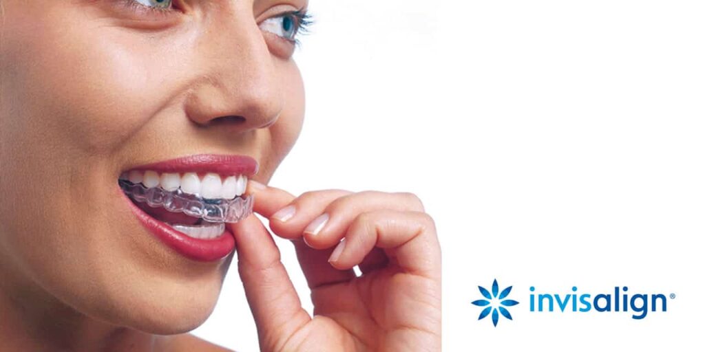 Invisalign marketing
